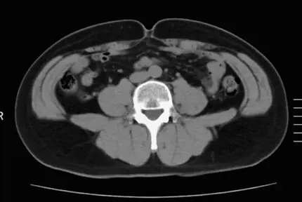OurAge×Webエクラ　BEFORE