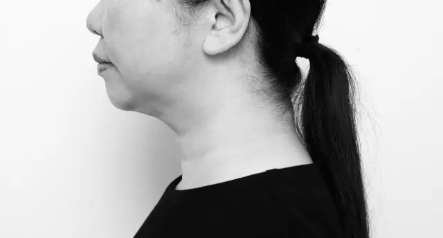 【施術直後】キュッとコンパクトに