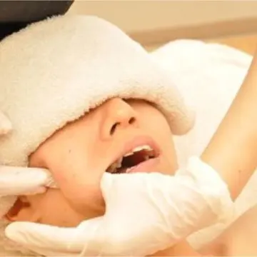 まるで整形。本来の自分が表れる口内エステの画像_2