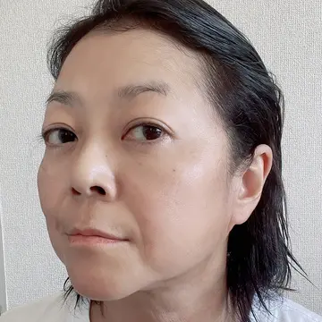 お手入れ後。
去年の夏に出来た頬のシミもこの程度で済んでいます。