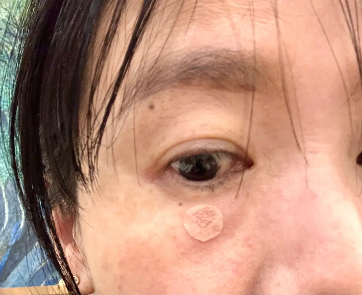 2月はレーザー照射月間😆の画像_3