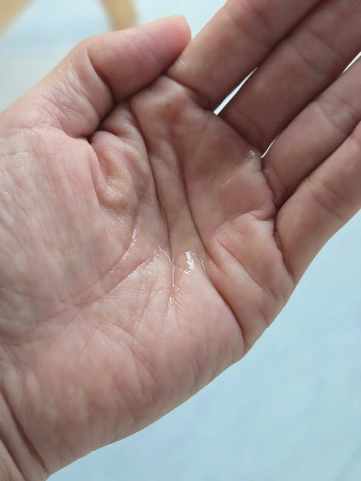 手のひらに汗が滲んでいる様子。皮膚の線がはっきりと見え、中央に汗が溜まっている。