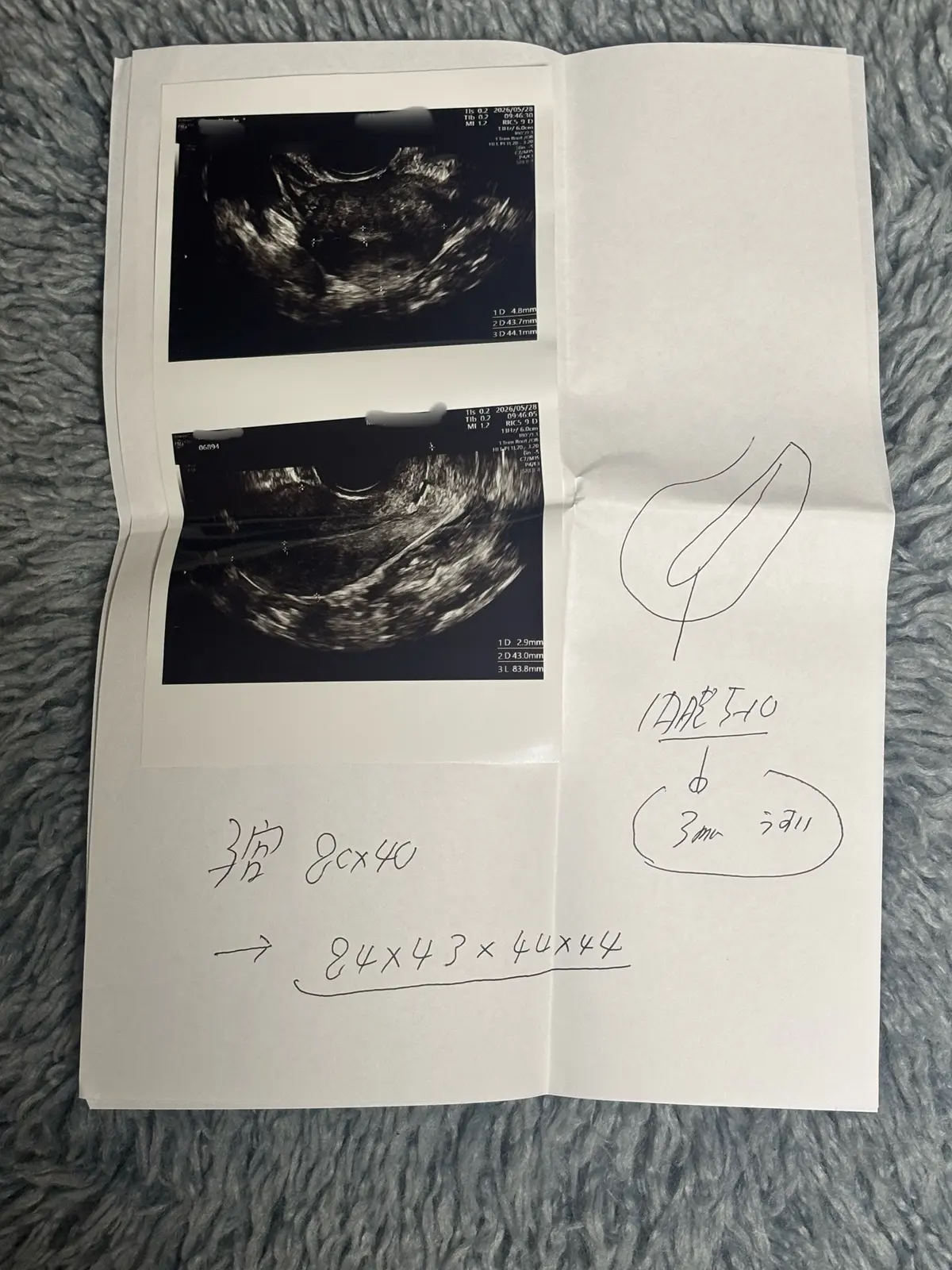 更年期の″ゆらぎ″を感じて婦人科への画像_2