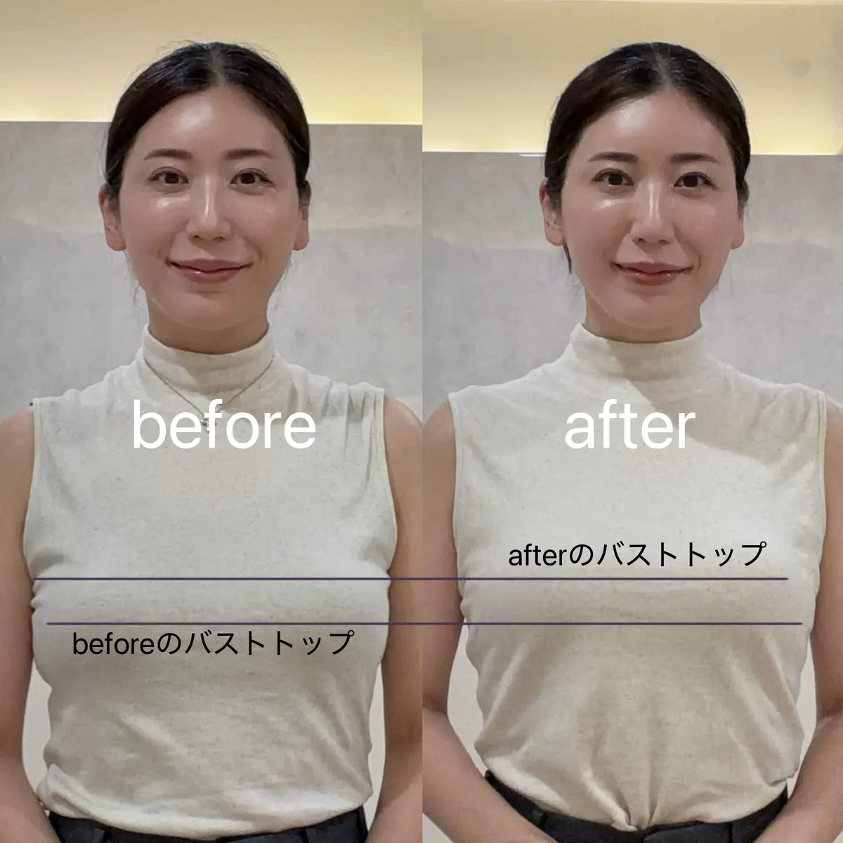 女性の顔のビフォーアフター写真。左は「before」、右は「after」と表示。肌のトーンが明るくなり、全体的に透明感が増している。両画像とも、ベージュのトップスを着用し、髪は後ろでまとめている。