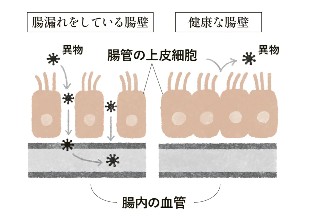 不調の悪循環を招く、“腸漏れ”に注意！　40代・50代の腸内環境を根本から立て直す「新・腸活」５つの心得