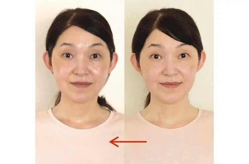 ビフォーアフター写真