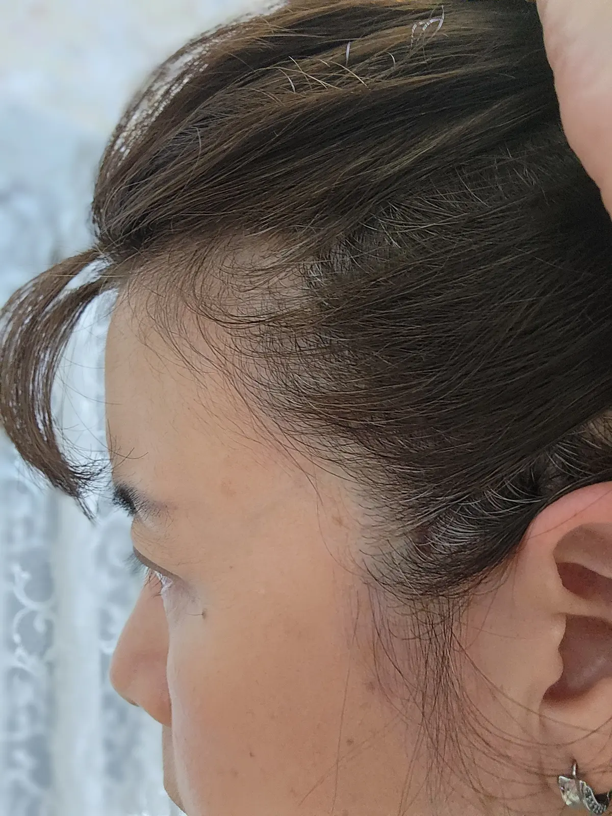 女性の顔の側面を捉えた写真。ダークブラウンの髪が分け目から生え際に向かって薄くなっている。右耳には小さなピアスが光っている。背景には白いレース模様が見える。