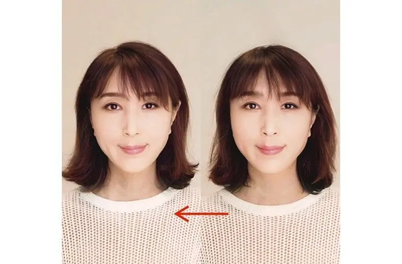 ビフォーアフター写真