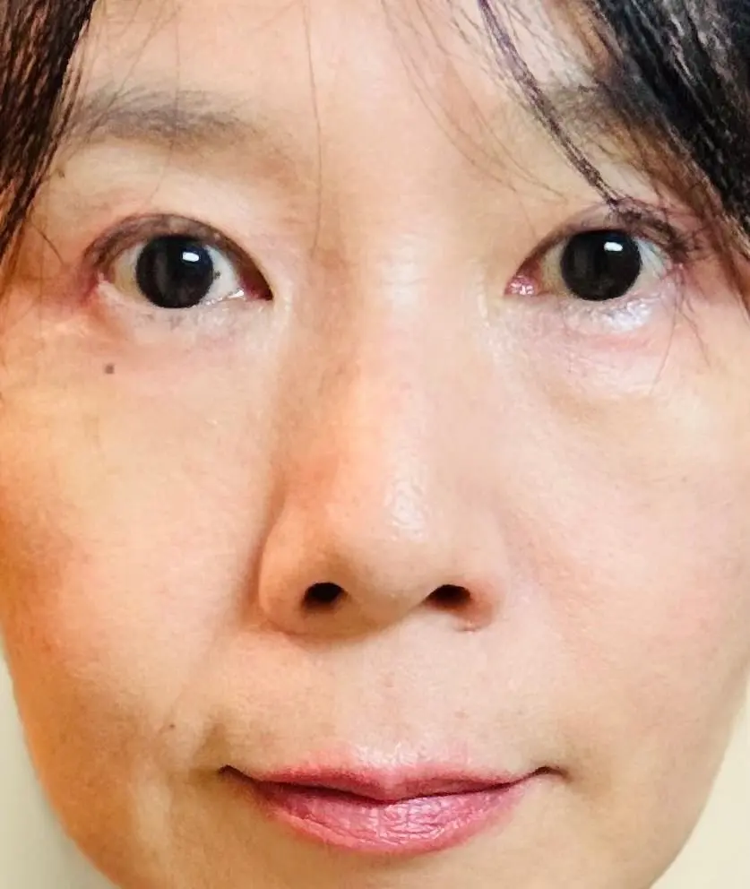 中央に鼻が位置する女性の顔のアップ。黒い瞳とわずかに開いた唇が特徴的。