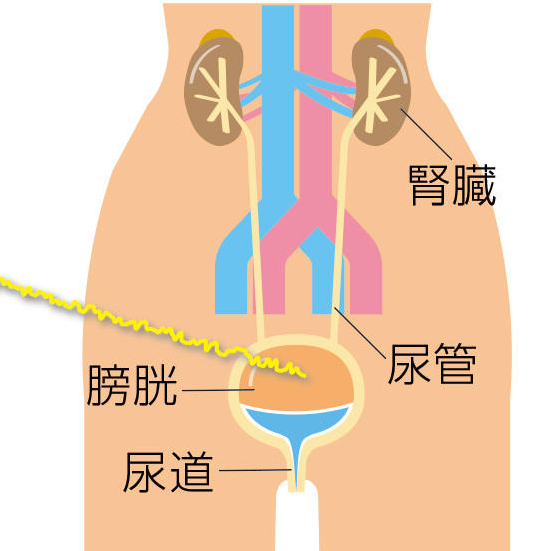 夜トイレに何度も起きる「夜間頻尿」の原因と“朝まで眠る”ための対策