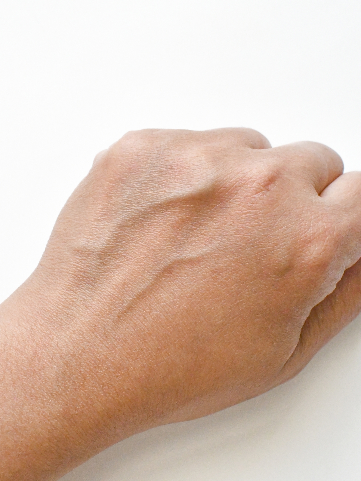 老け感が増す「手の血管浮き」。年齢を重ねると目立つのをどうしたらいい？