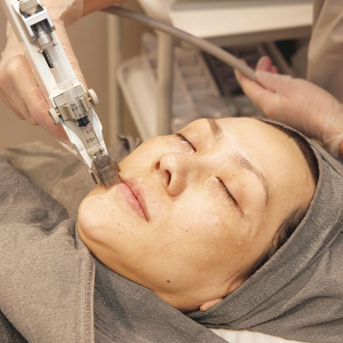 疲れて見える目の下のゴルゴライン、シワっぽくなった唇におすすめの施術は？【50代の「顔立ち悩み」解決テク】