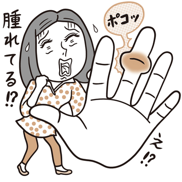 見逃さないで！ 更年期世代の「手指の不調」の部位と違和感はこれ！