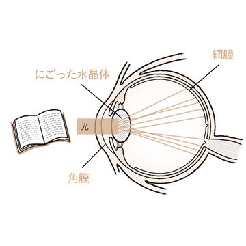 「白内障」は老化現象のひとつ。早めに受診をして予防を