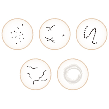 目の前に浮かぶヘンなものが、急激に増えたら要注意！「飛蚊症」の症状と予防法