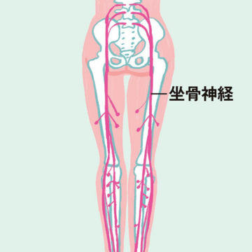 放っておかないで！腰や足の“ピリピリ痛”それは「坐骨神経痛」の症状！対処法を医師が解説