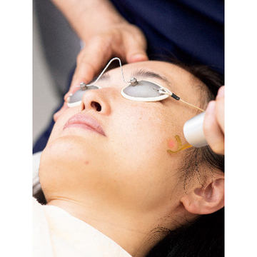 「初めてのシミとり」施術体験レポート①メイクで隠れなくなった【肥大ジミ】