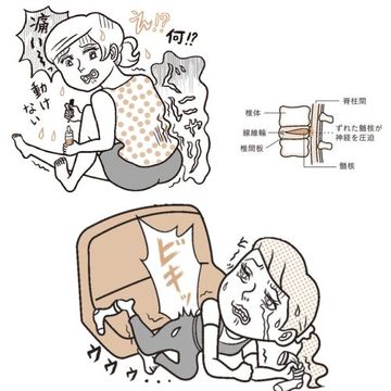経験者多数！アラフィー女性の「ぎっくり腰」正しい対処法と予防策