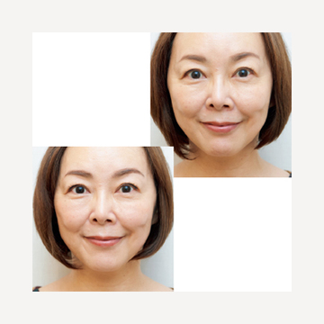 ＜今日から本気の「たるみ目」ケア＞目まわりが引き締まるのを実感！「目もとハイフシャワー」体験ルポ