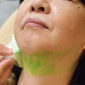 あごが小さい人や部分やせしたい人におすすめな「アヴェニュー六本木クリニック」