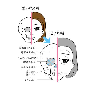 顔のたるみの隠れた重大原因「顔面の骨やせ」とは？　