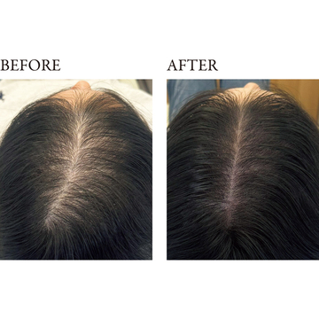 【50代「増毛」の最新トピックス】アートメイク＆ヘアピースで“自然に増やす”選択肢を