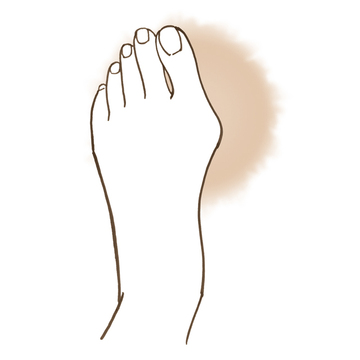 【50代 “清潔感のある脚”を目指す】今からでも解決できる!? 足の3大悩みあるある足トラブルの原因＆対処法