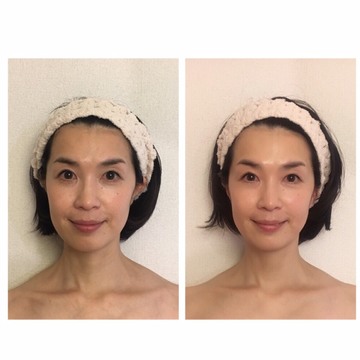 まるで整形。本来の自分が表れる口内エステ