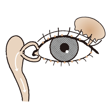 涙の変化が原因で生じる「ドライアイ」の症状、ケアの方法は？