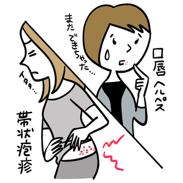 帯状疱疹とヘルペスの違いは？あとが残ってしまう？4つのQ&A