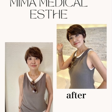 寒暖差によるお肌の悩みに、美馬メディカルエステに✨