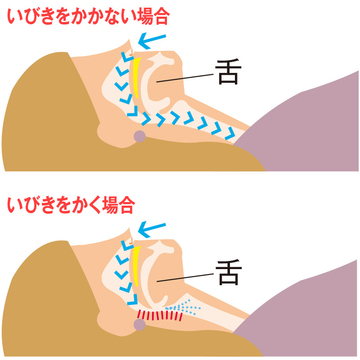  更年期に「いびきが増える」原因って？1週間で変わる改善法を専門医に聞きました